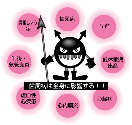 歯周病の原因（１）