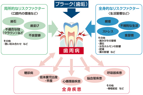 糖尿病と歯周病について☆