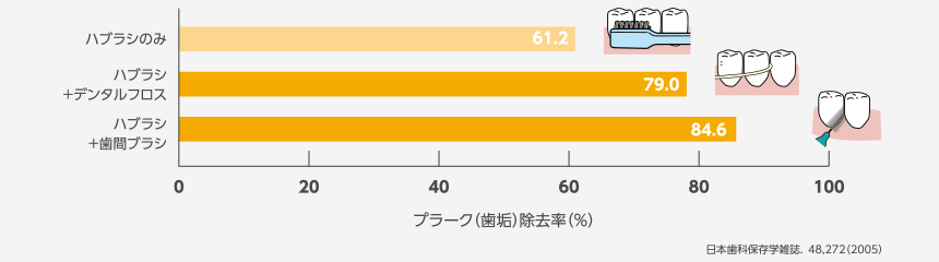 歯間ブラシ使っていますか？