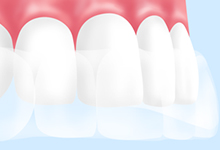 歯に一定時間装着