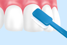 マウストレーを外した後にはブラッシング